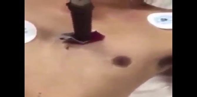 Göğsüne Bıçak Saplandı