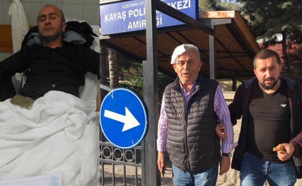 Çorumlu Gazeteciler Kazada Yaralandı