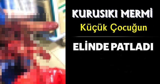 Küçük Çocuğun Elinde Patladı