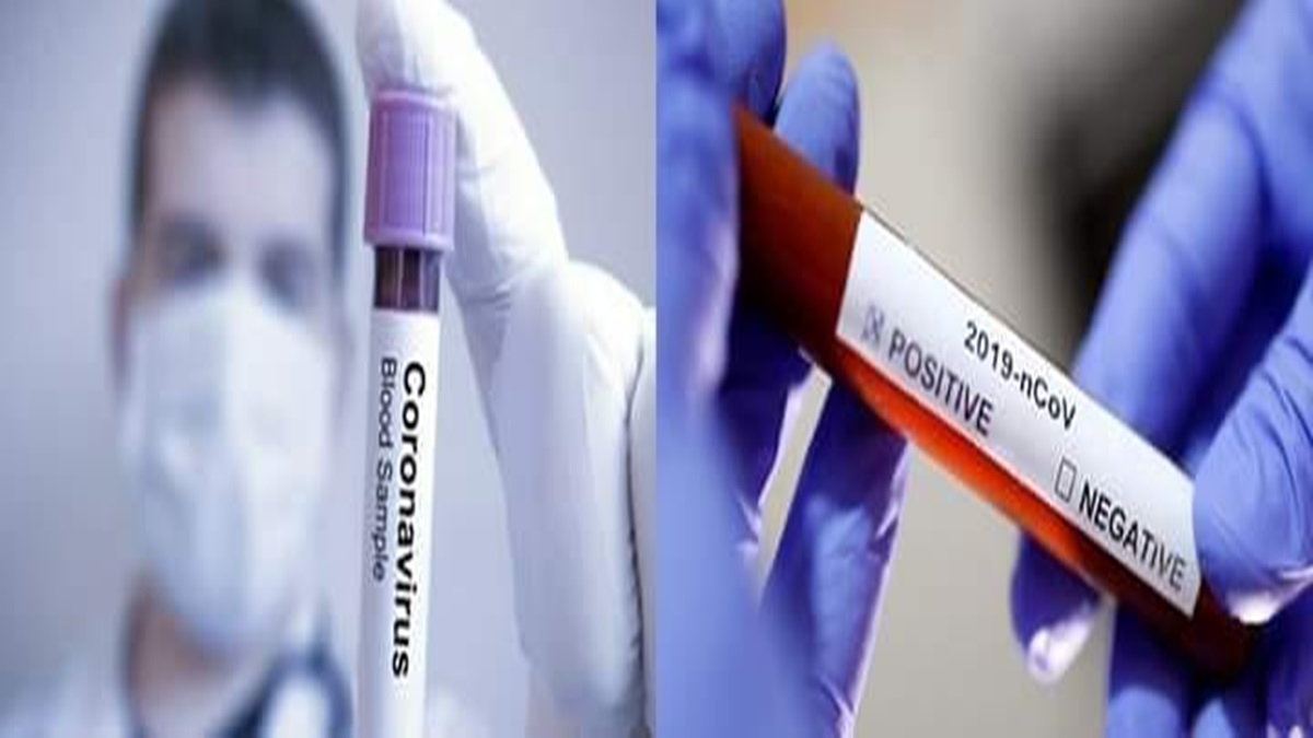 Sungurlu’da 1 Kişinin Testi Pozitif Çıktı