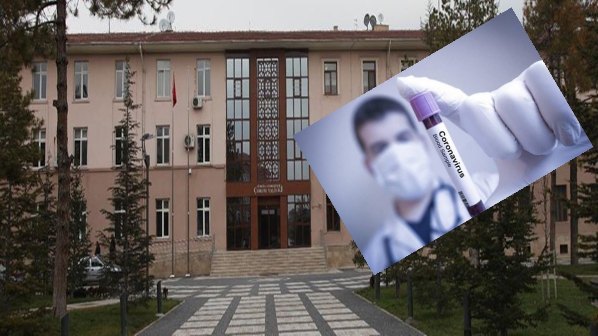 Çorum’da ki Hastaların Testleri Negatif