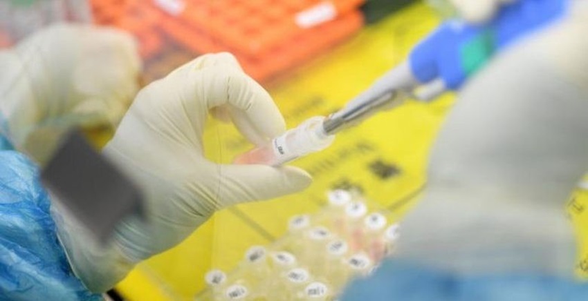 Çorum’da ki (Covid-19) Tanı Laboratuvarı Hizmete Devam Ediyor