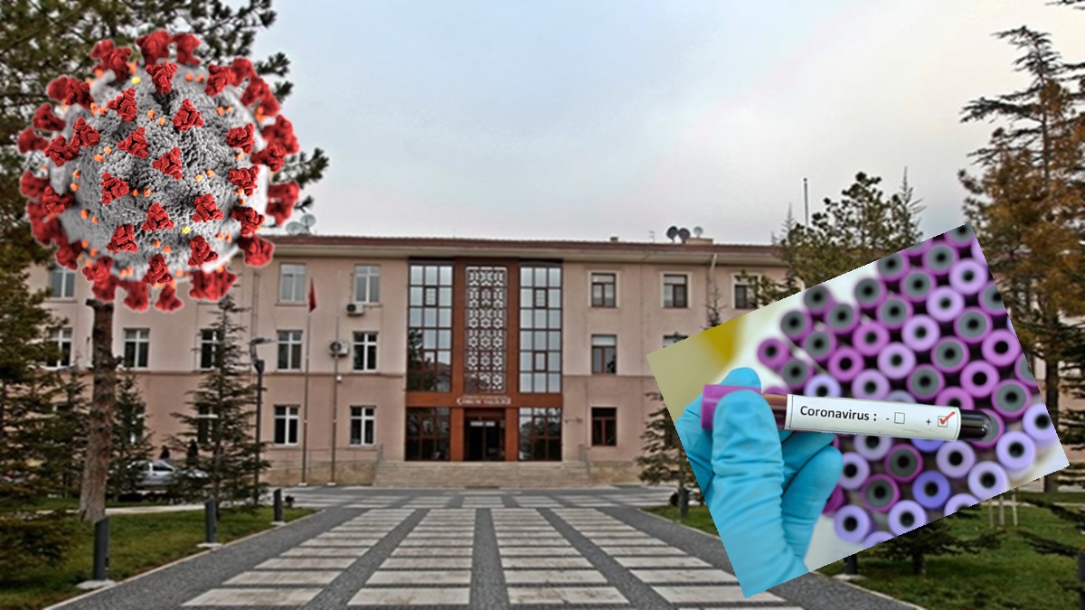 Çorum’da 497 Kişiye Test Yapıldı