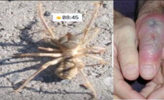 Kargı’da Tehlikeli Sarıkız Örümceği Görüldü