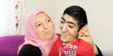 Özkan Hayat Mücadelesini Kaybetti