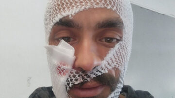 İneğin Saldırısına Uğrayan Genç Yaralandı